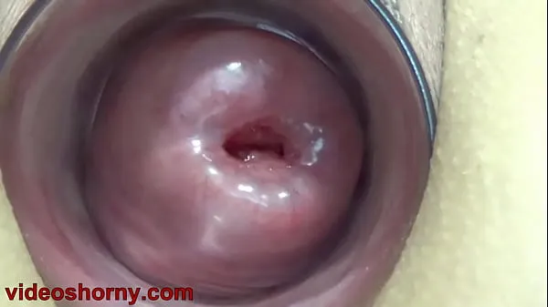 New Uterus Penetration with Objects, Pumping Cervix Prolapse my Movies