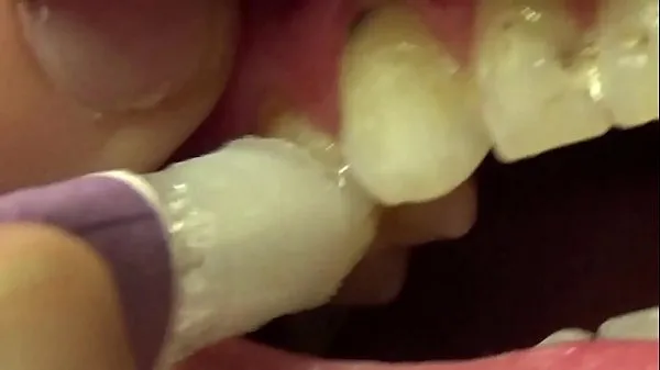 Ny Applying Whitening Paste To Her Filthy Teeth mine film